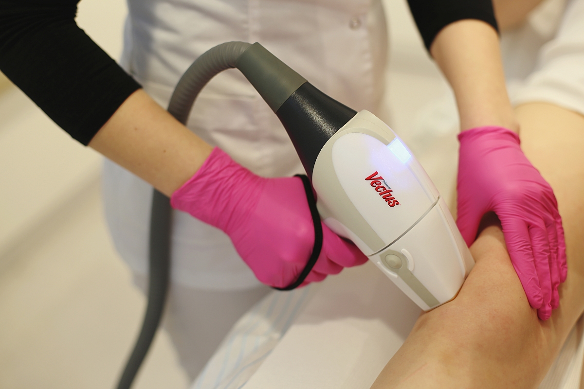 Laser Vectus - depilacja laserowa
