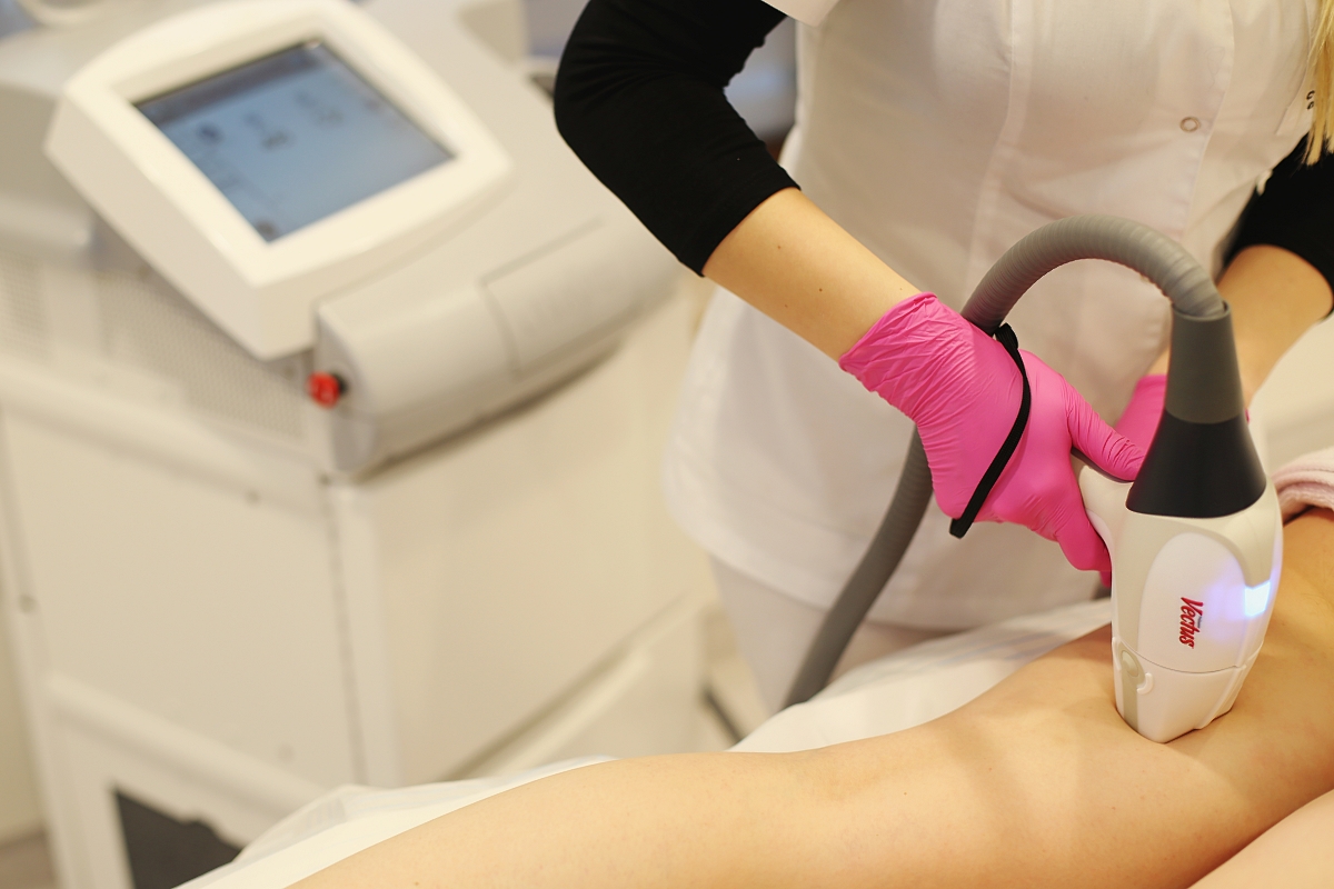 Laser vectus - depilacja laserowa nóg